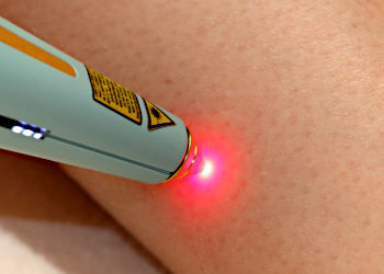 LLLT-Handlaser zur Laserakupunktur